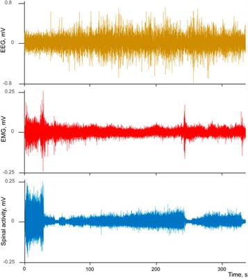 Somatovisceral Convergence in Sleep-Wake Cycle: Transmitting Different Types of Information via the Same Pathway